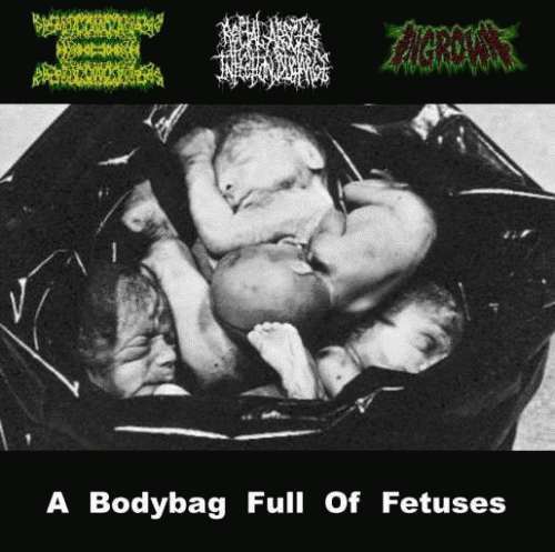 Ingrown : A Bodybag Full of Fetuses